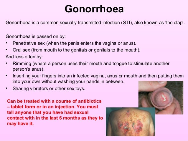Oral sex infections